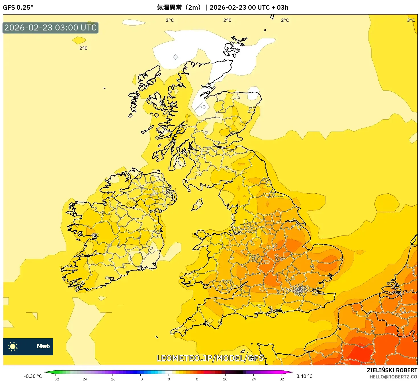 GFS model - イギリス, 気温異常（2m）