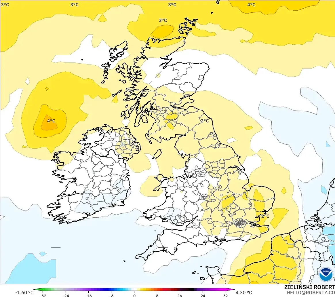 GFS モデル - イギリス, 気温異常（850hPa）