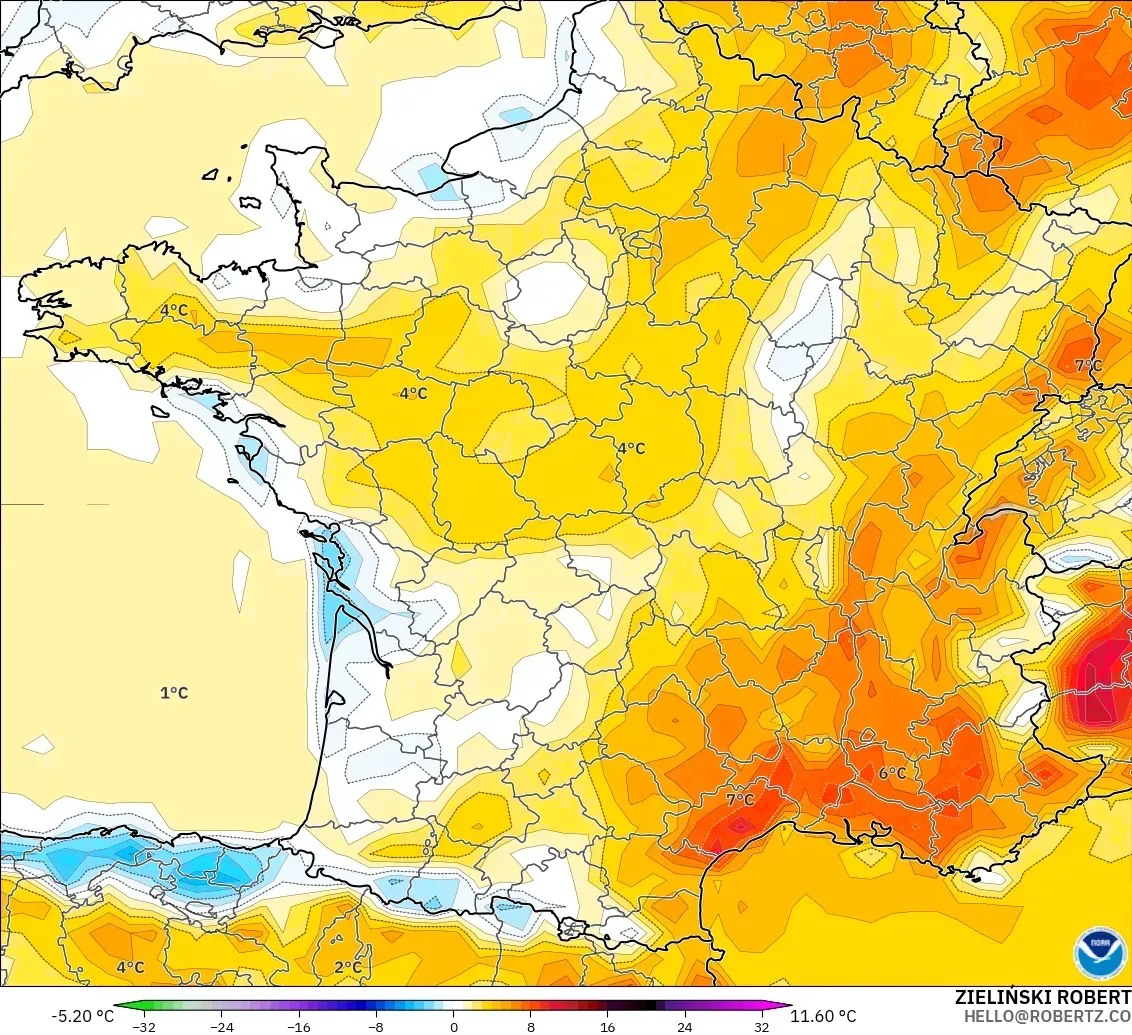 GFS モデル - フランス, 気温異常（2m）