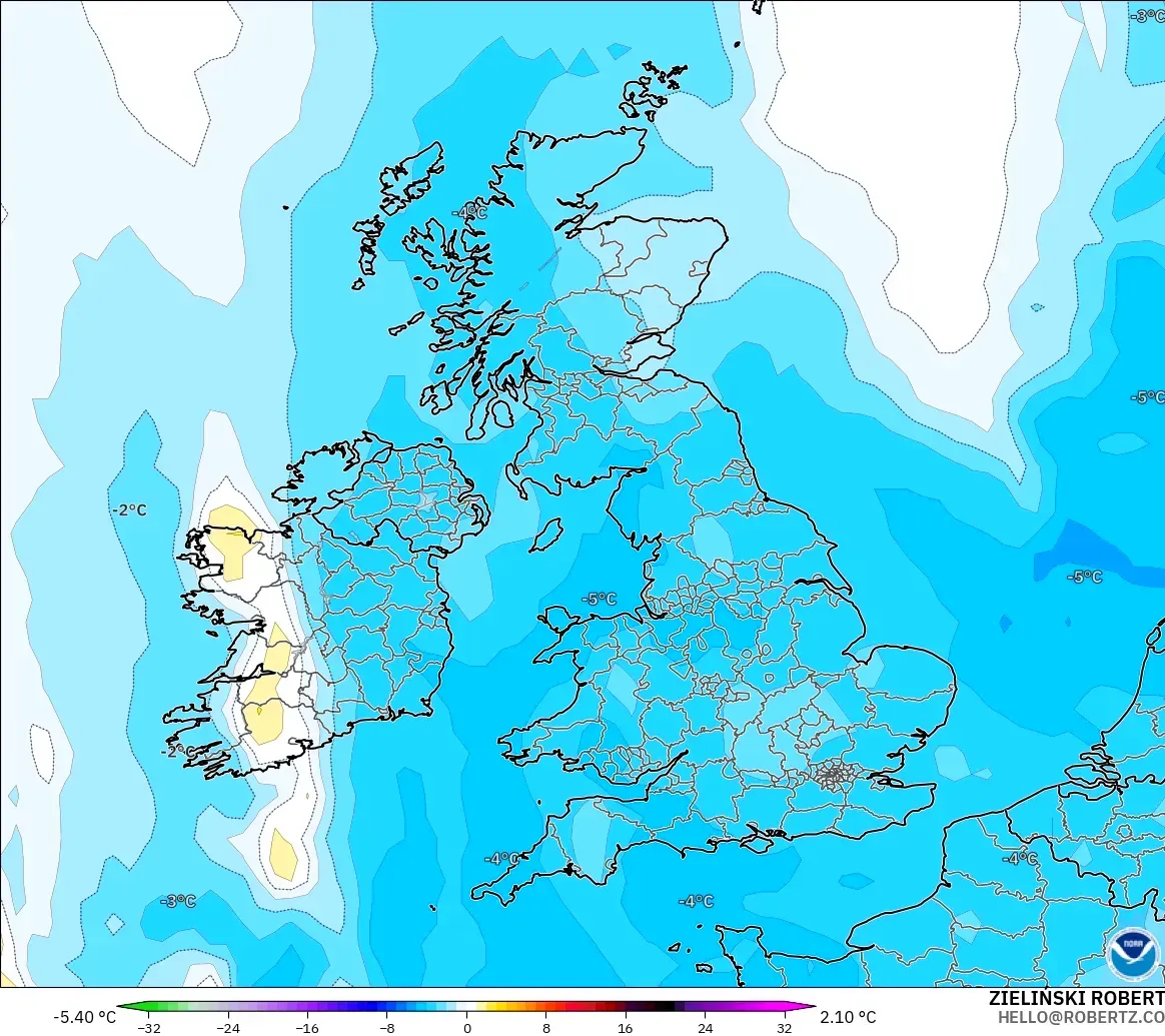 GFS モデル - イギリス, 気温異常（850hPa）